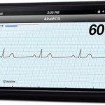 AliveCor Heart Monitor